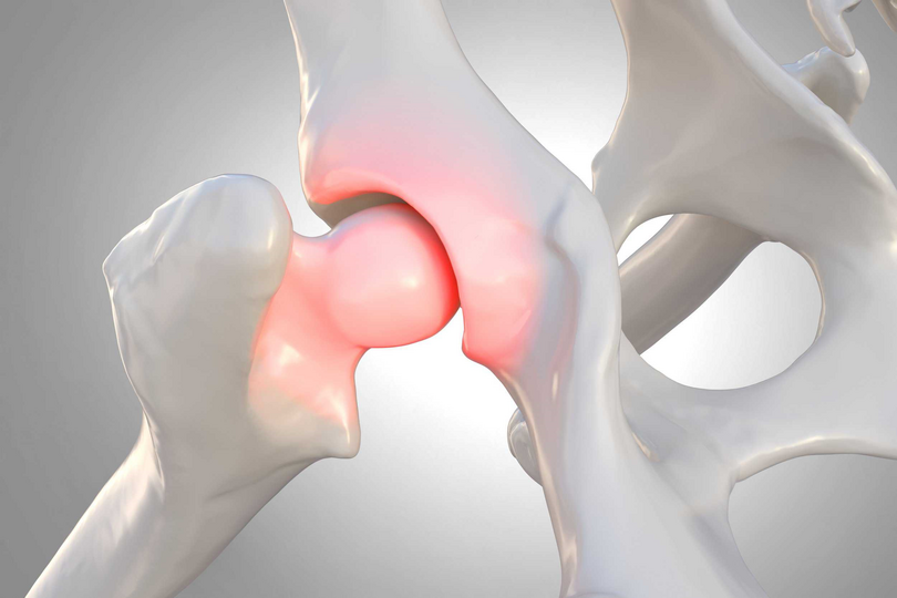 hip elbow dysplasia dog